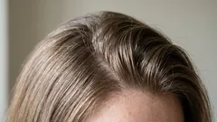 Włosy szybko się przetłuszczają: dlaczego tak się dzieje i co z tym zrobić?